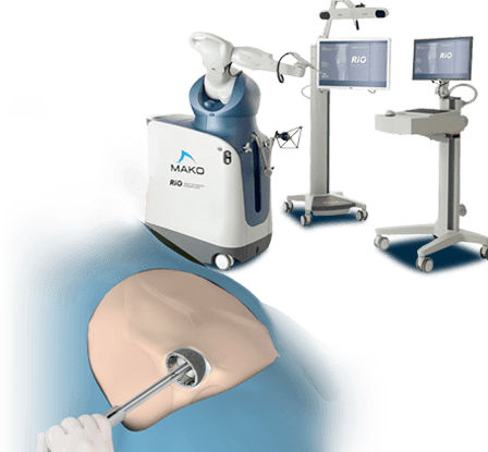 MAKOplasty ® Robotic Assisted Hip & Knee Surgery