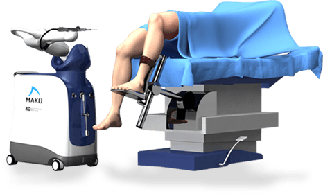 MAKOplasty ® Robotic Assisted Hip & Knee Surgery